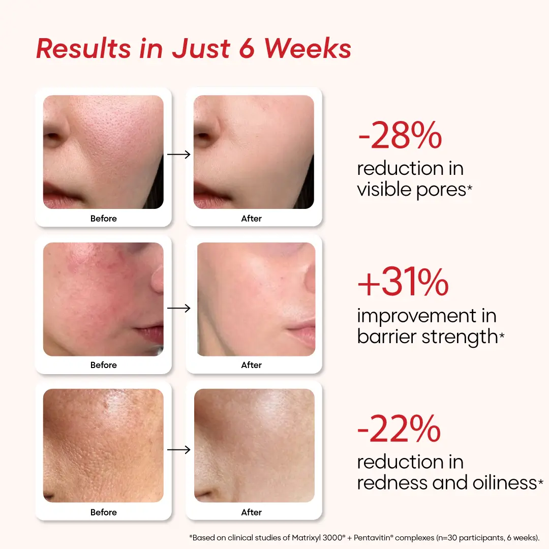 Inside Out Beauty Stack - Image 14